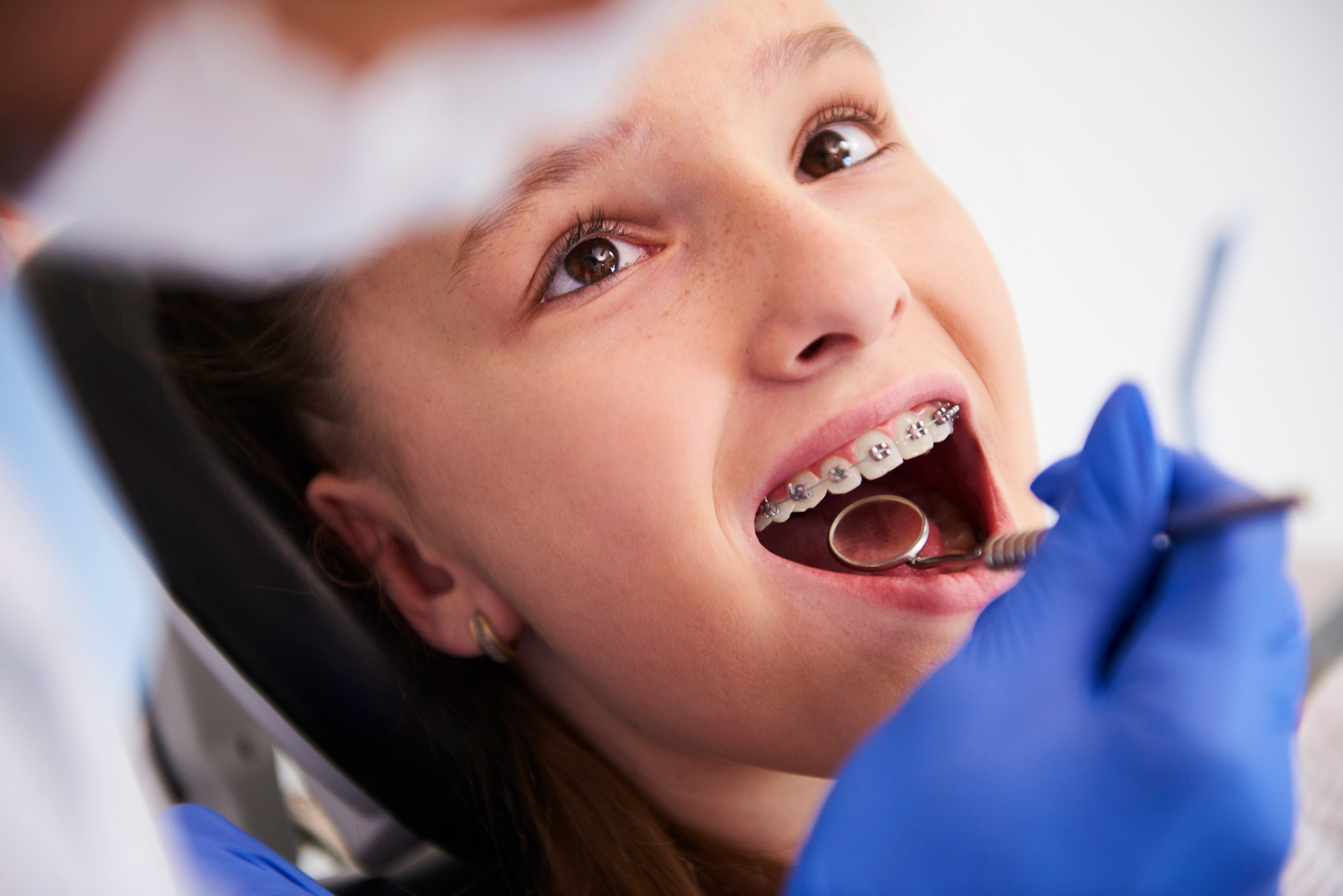 chica-brackets-examen-dental-rutina