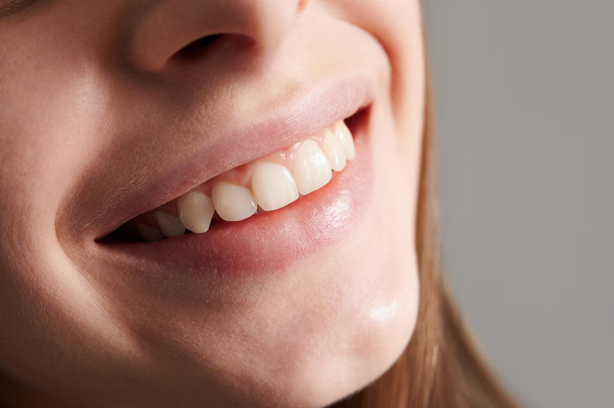 hermosa-sonrisa-femenina-dientes-rectos-blancos